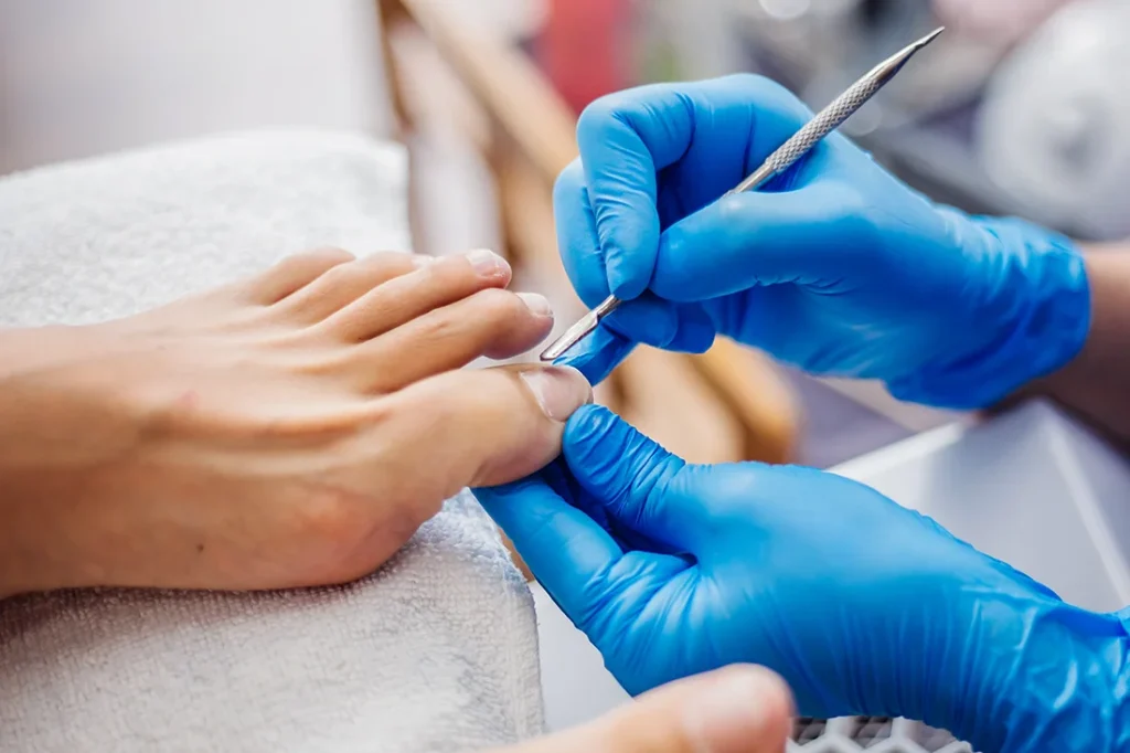 podologo en murcia. cuidado de los pies